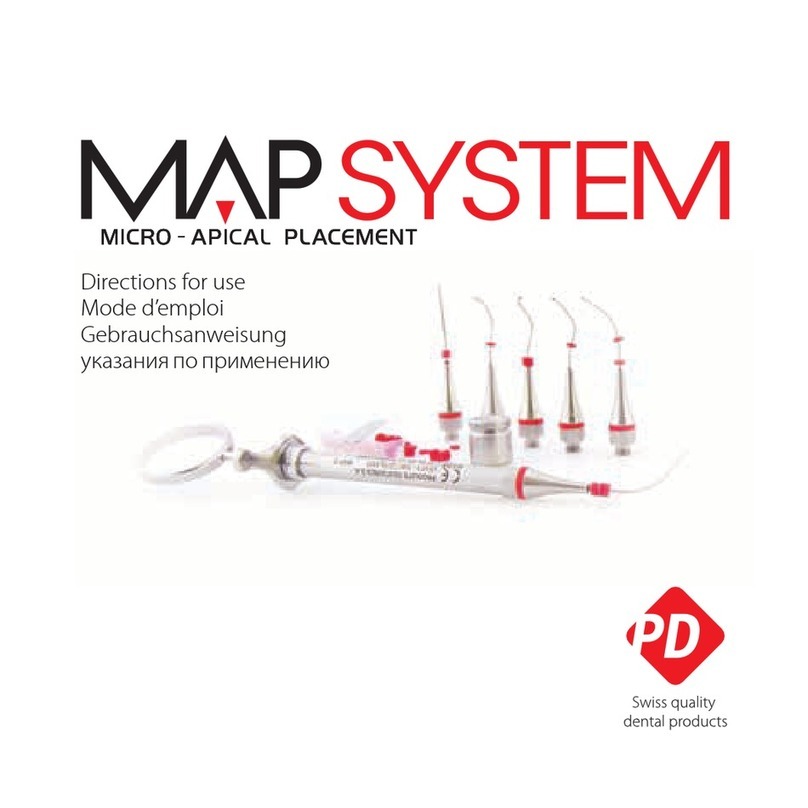 Produits Dentaires MAP System Directions for use
