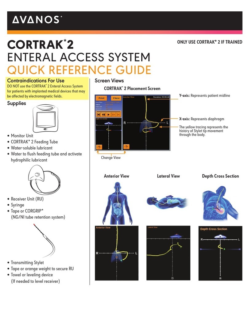 Avanos CORTRAK 2 Quick reference guide Avanos CORTRAK 2 Quick reference guide