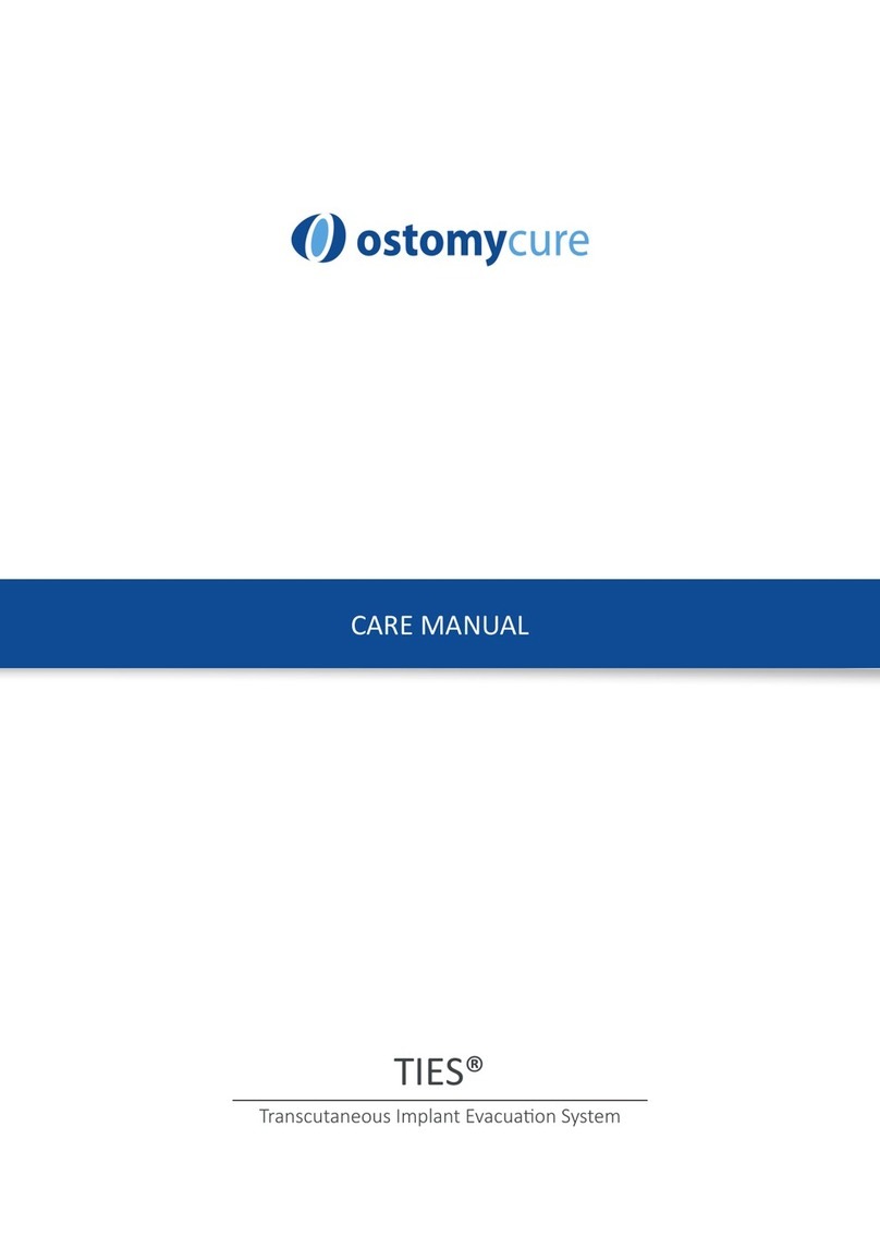 OstomyCure TIES Care manual