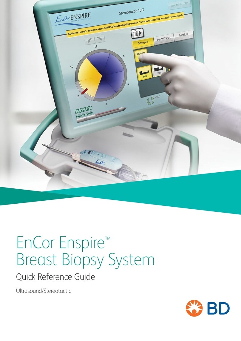 BD EnCor Enspire Quick reference guide BD EnCor Enspire Quick reference guide