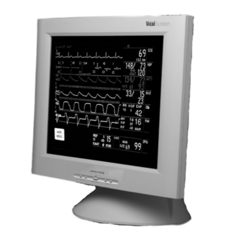 Planar VitalScreen S VSS17SX User manual