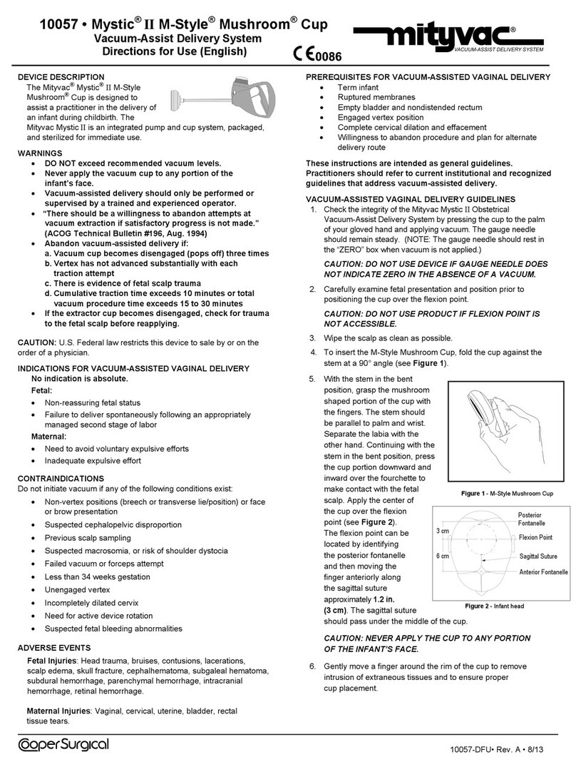 Cooper Surgical mityvac Mystic II M-Style Mushroom Cup Directions for use Cooper Surgical mityvac Mystic II M-Style Mushroom Cup Directions for use