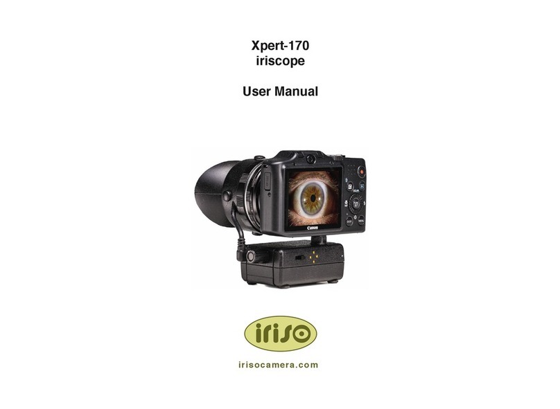 Iriso Xpert-170 user manual