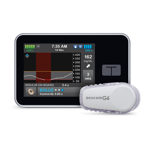 Dexcom Tandem t instructions