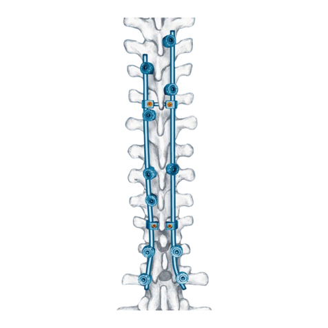 Synthes Small Stature USS User manual Synthes Small Stature USS User manual