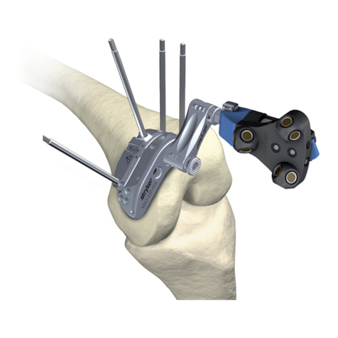 Stryker Navigated MIS Jig-A User manual