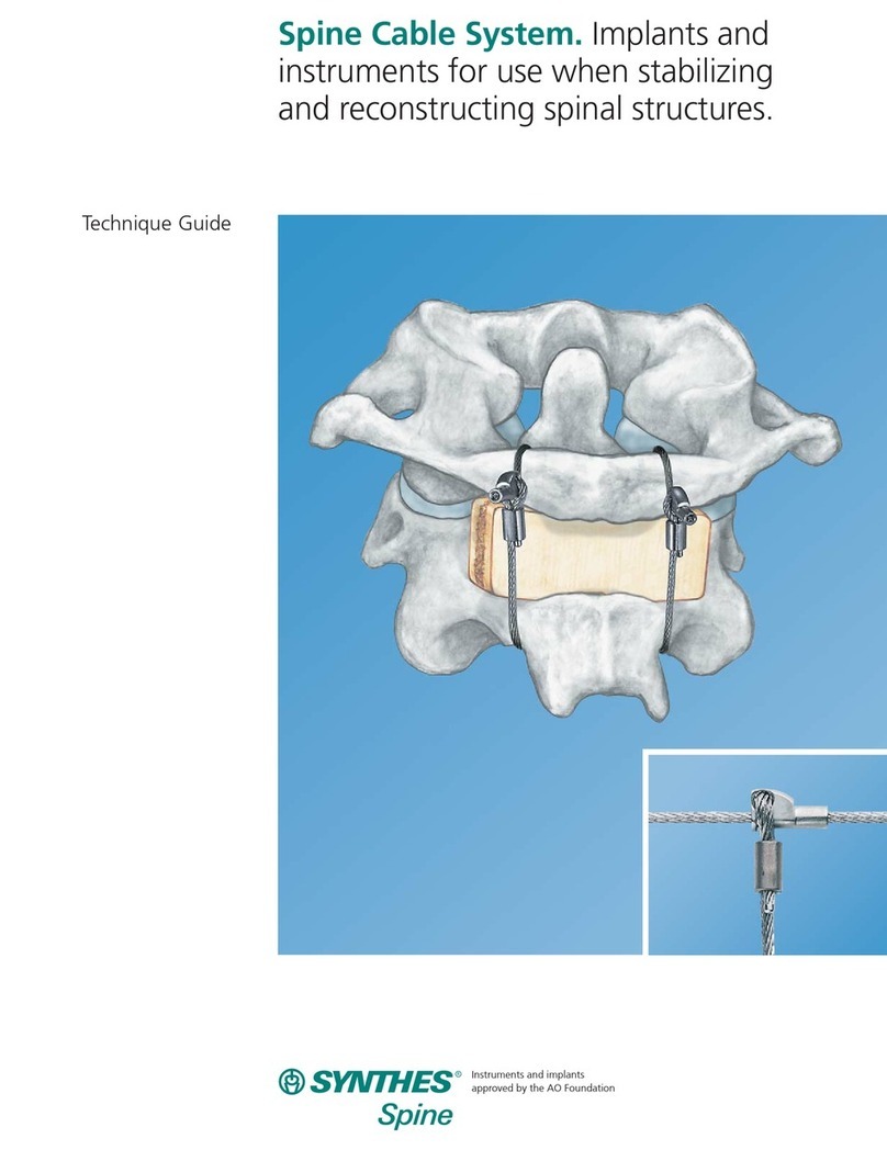 Synthes Spine Cable System Technical guide