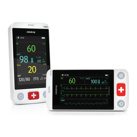 Mindray TM70 User manual