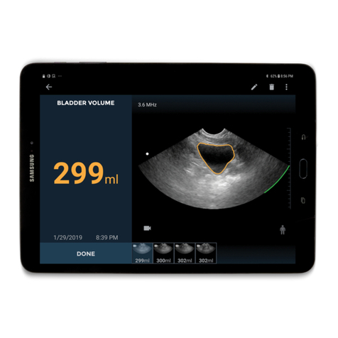 EchoNous Uscan User manual EchoNous Uscan User manual