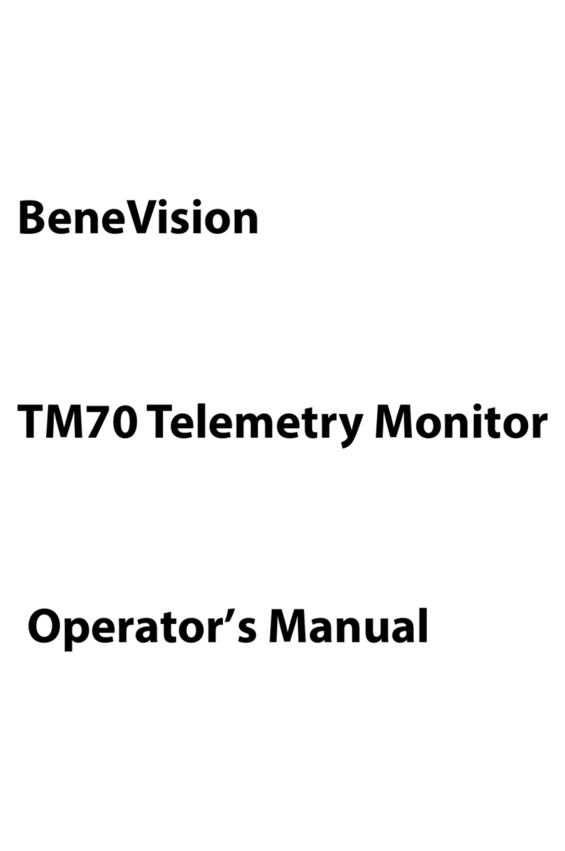 BeneVision TM70 Operator's manual