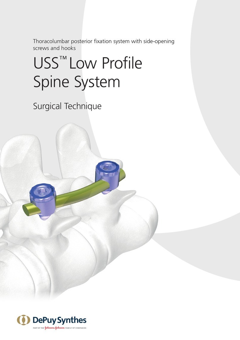 Synthes USS Low Profile SURGICAL TECHNIQUE