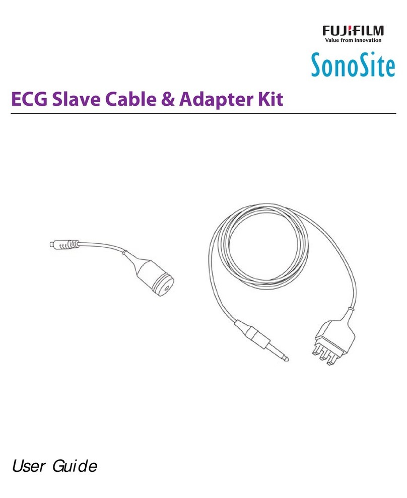 SonoSite ECG User manual