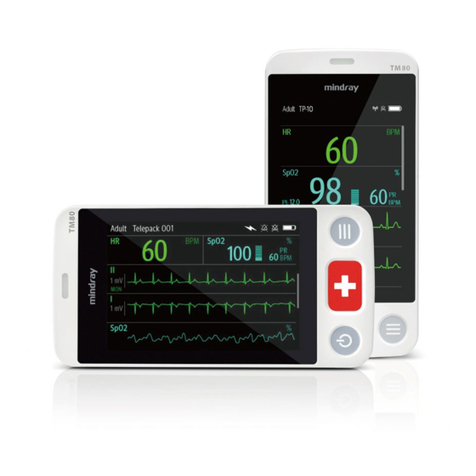 BeneVision TM80 User manual