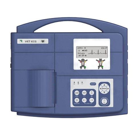 EDAN INSTRUMENTS VE-100 User manual EDAN INSTRUMENTS VE-100 User manual