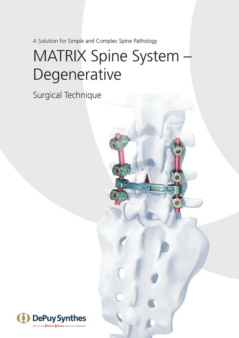 Johnson & Johnson DePuy Synthes MATRIX User manual