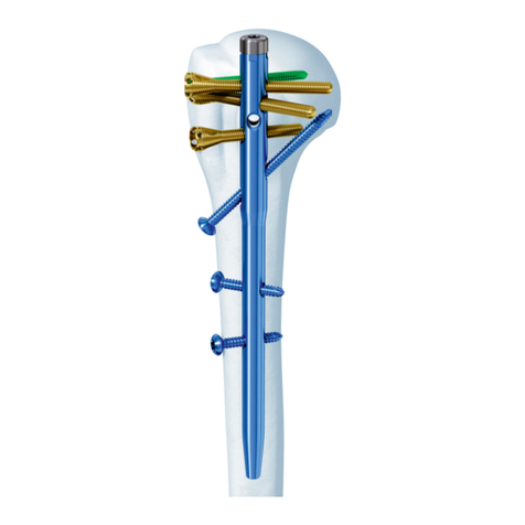Synthes MultiLoc Proximal Humeral Nail User manual Synthes MultiLoc Proximal Humeral Nail User manual