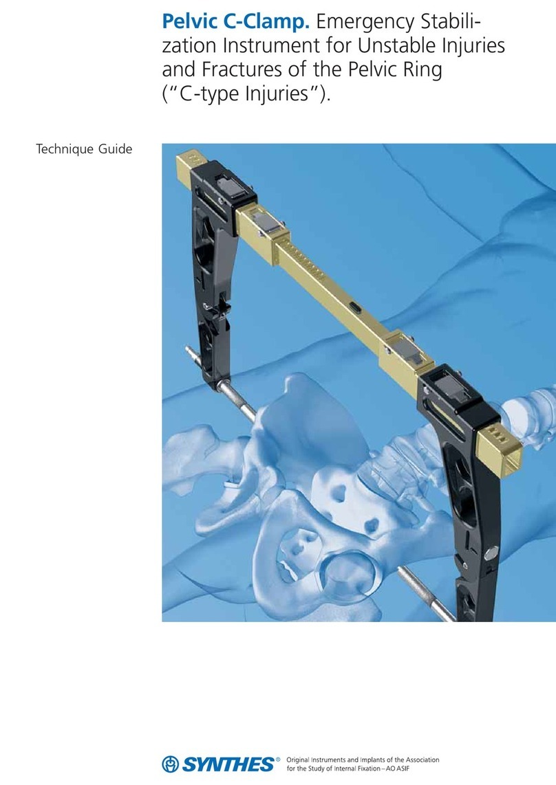 Synthes Pelvic C-Clamp Technique guide