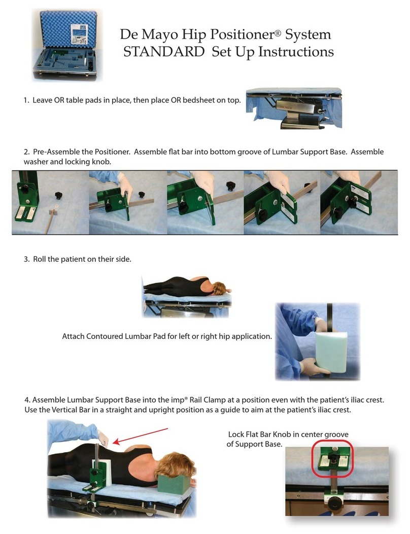 IMP De Mayo Hip Positioner System STANDARD Setup instructions