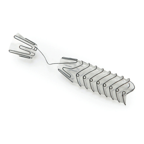 Allium Bulbar Urethral Stent Instructions for use