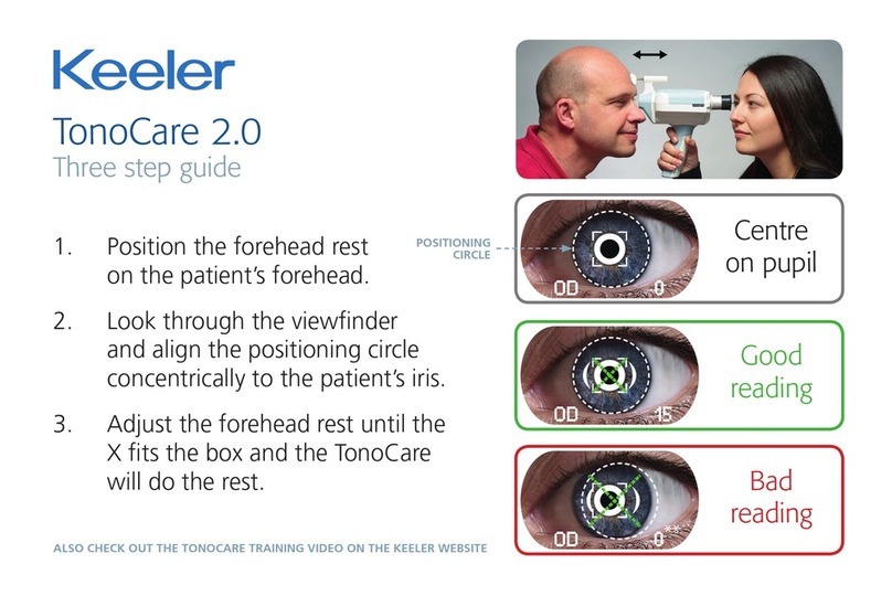 Keeler TonoCare 2.0 Three step guide