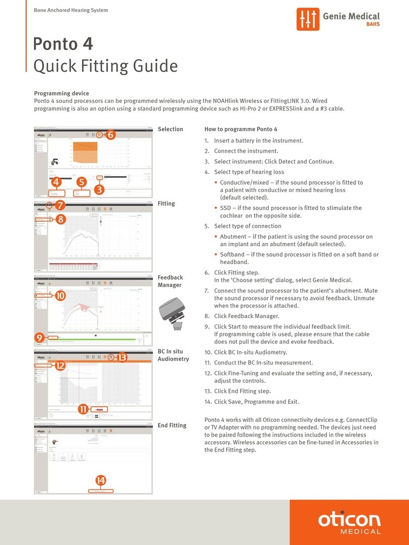 Oticon Medical Ponto 4 Quick Fitting Guide