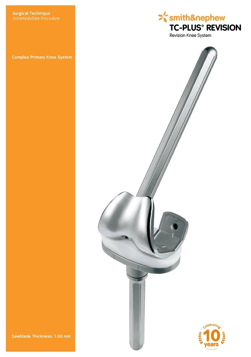 Smith & Nephew TC-PLUS Revision User manual