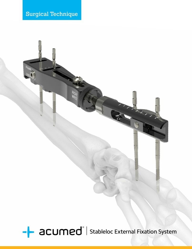 acumed Stableloc External Fixation System SURGICAL TECHNIQUE