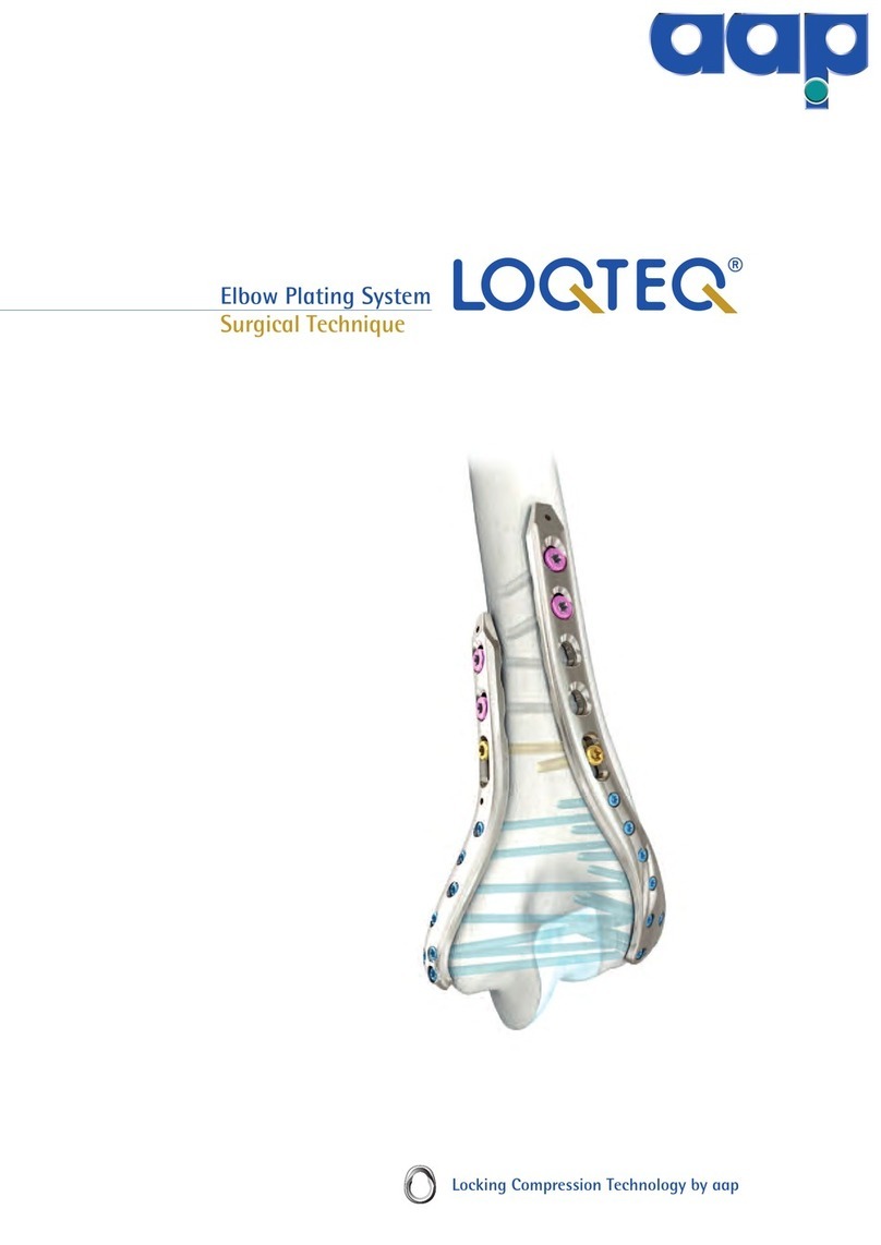 AAP LOQTEQ Distal Dorsolateral Humerus Plate... manual AAP LOQTEQ Distal Dorsolateral Humerus Plate... manual