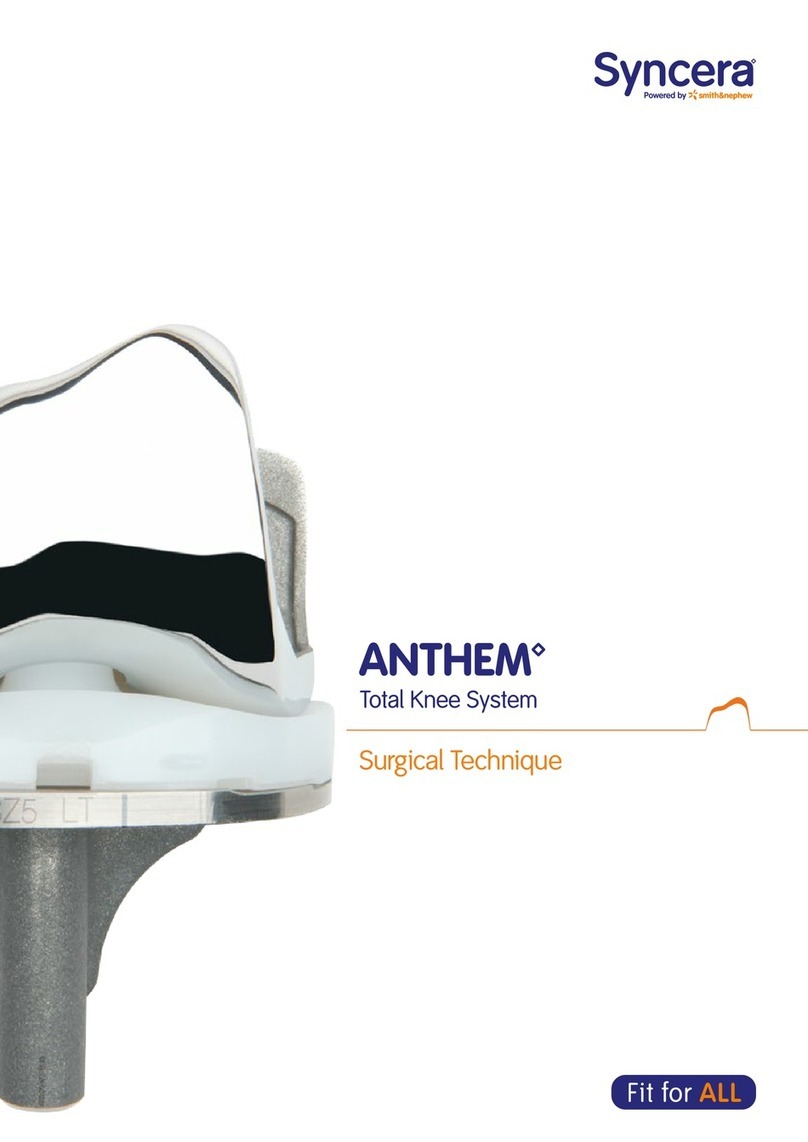 Smith & Nephew Syncera Anthem Surgical Techniques