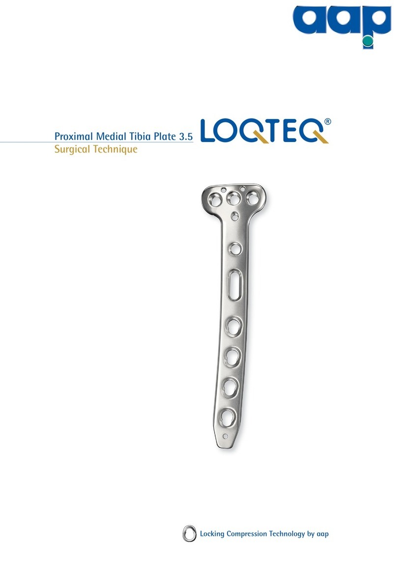 AAP LOQTEQ Proximal Medial Tibia Plate 3.5 manual AAP LOQTEQ Proximal Medial Tibia Plate 3.5 manual