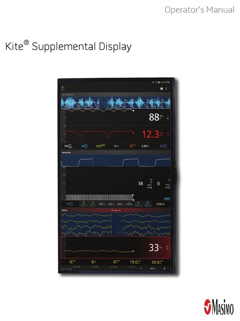 Masimo Kite Operator's manual