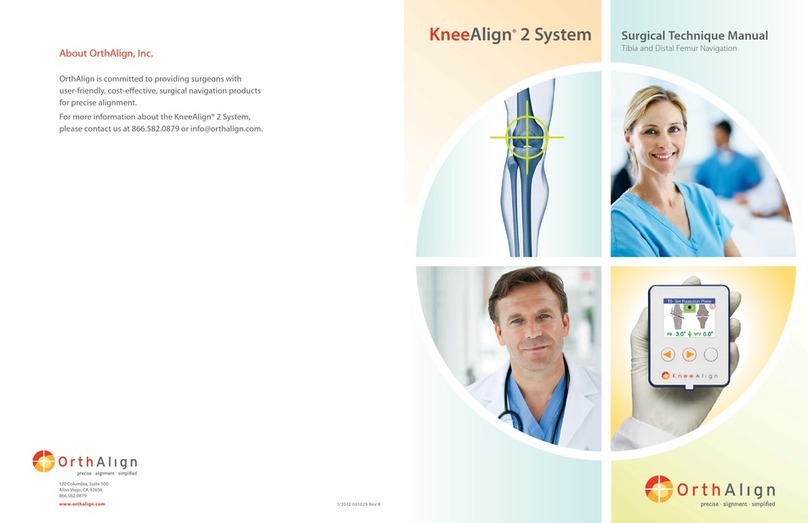 OrthAlign KneeAlign 2 System TECHNIQUE MANUAL
