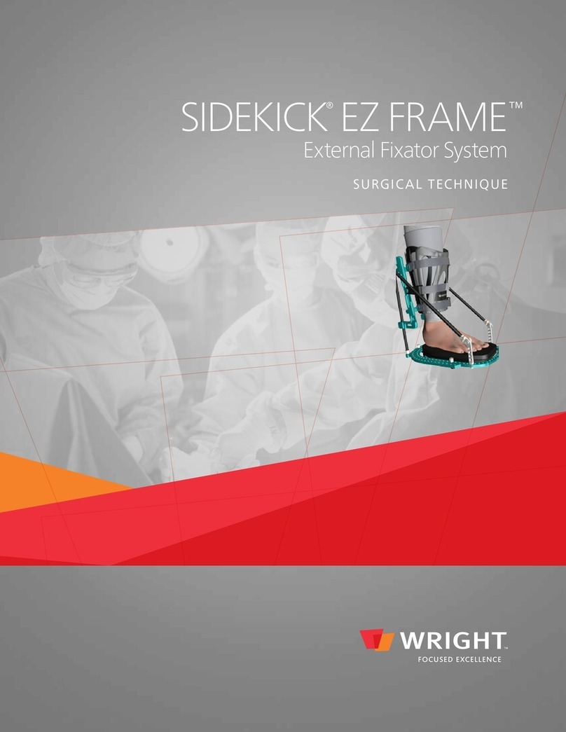 WRIGHT SIDEKICK EZ FRAME SURGICAL TECHNIQUE