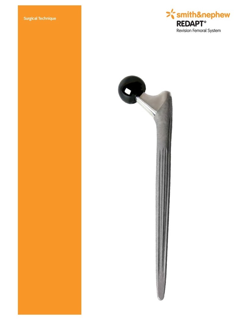 Smith & Nephew REDAPT SURGICAL TECHNIQUE