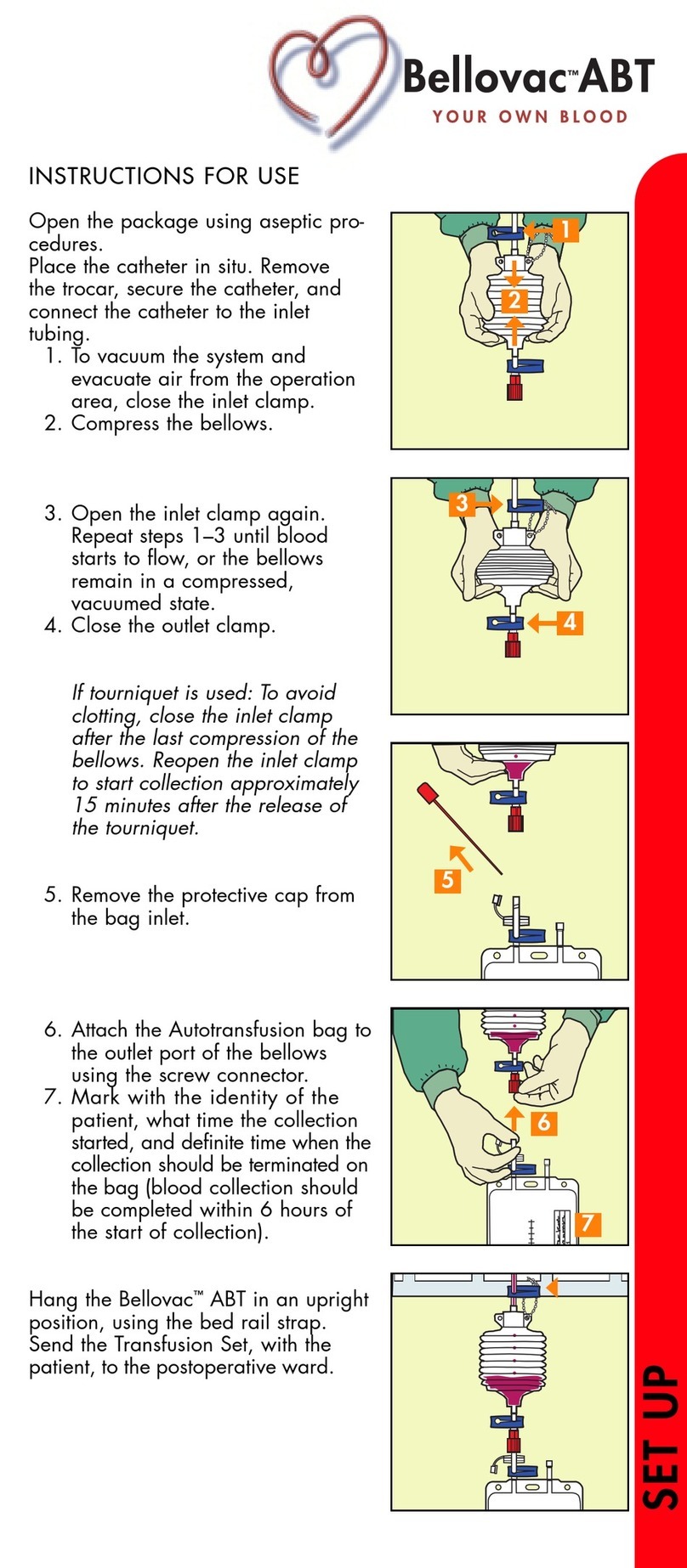 Bellovac ABT Instructions for use