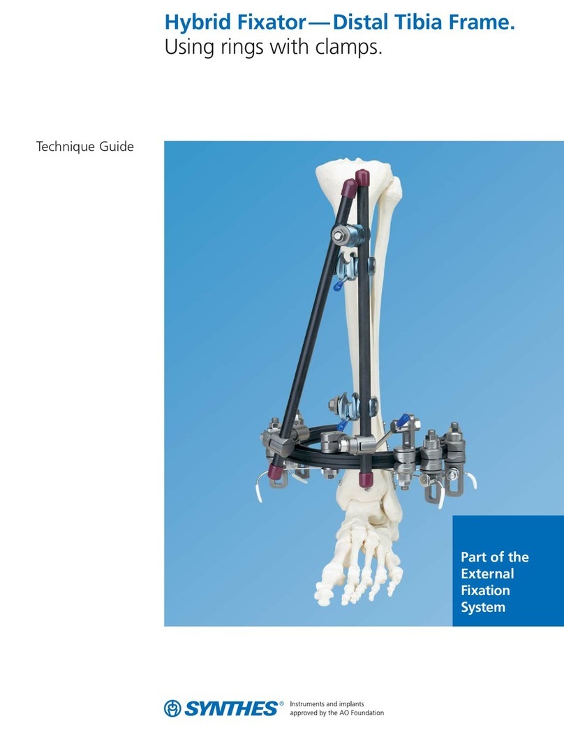 Synthes Hybrid Fixator User manual Synthes Hybrid Fixator User manual