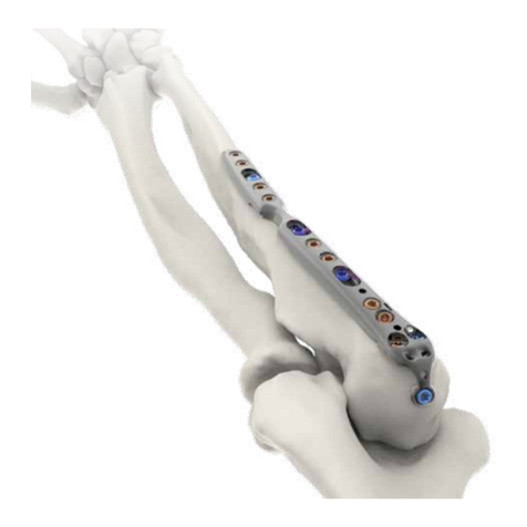 skeletal dynamics DISTAL ELBOW SET Surgical Technique Guide