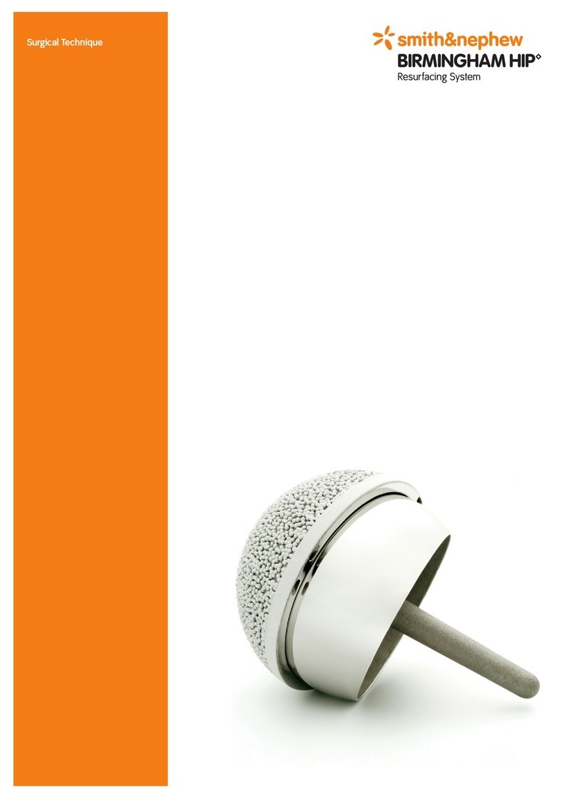 Smith & Nephew BIRMINGHAM HIP SURGICAL TECHNIQUE
