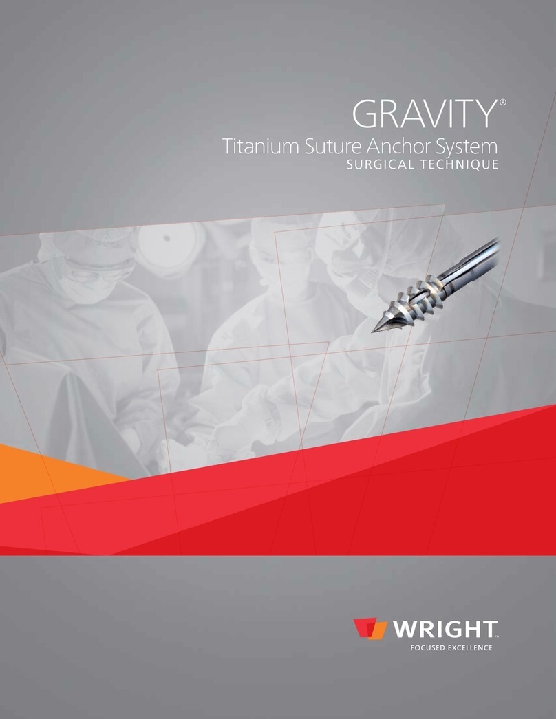 Wright Medical Technology GRAVITY Series SURGICAL TECHNIQUE Wright Medical Technology GRAVITY Series SURGICAL TECHNIQUE
