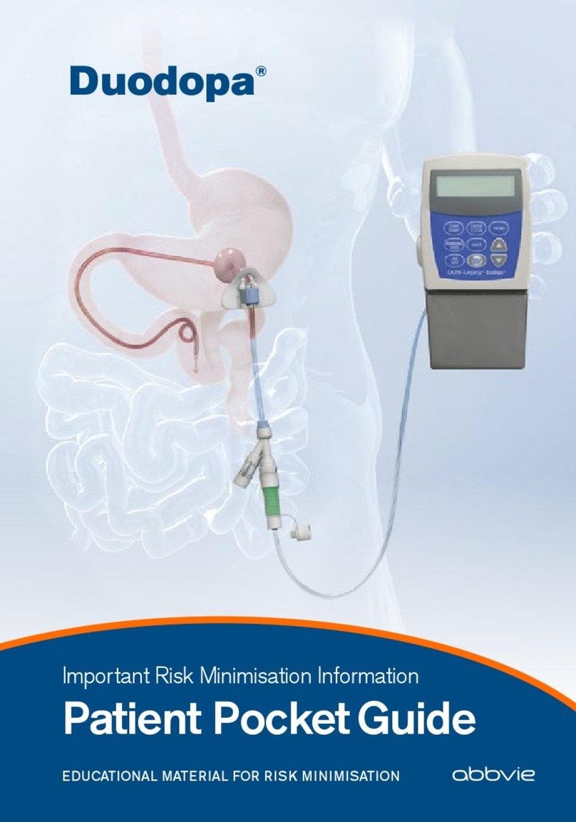 AbbVie Duodopa Patient Pocket Guide