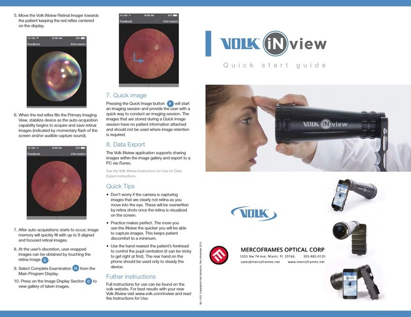 Mercoframes Optical Corp Volk iNview quick start guide Mercoframes Optical Corp Volk iNview quick start guide