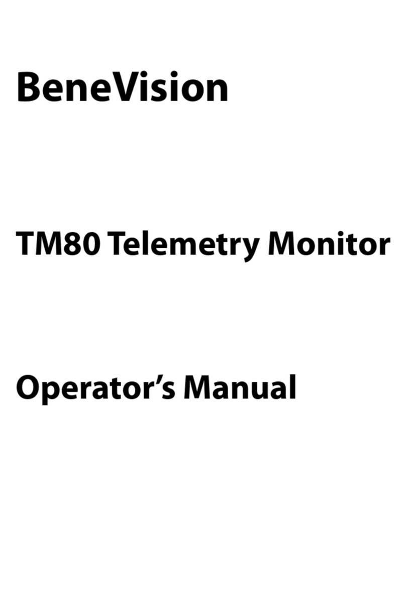 Mindray BeneVision TM80 User manual