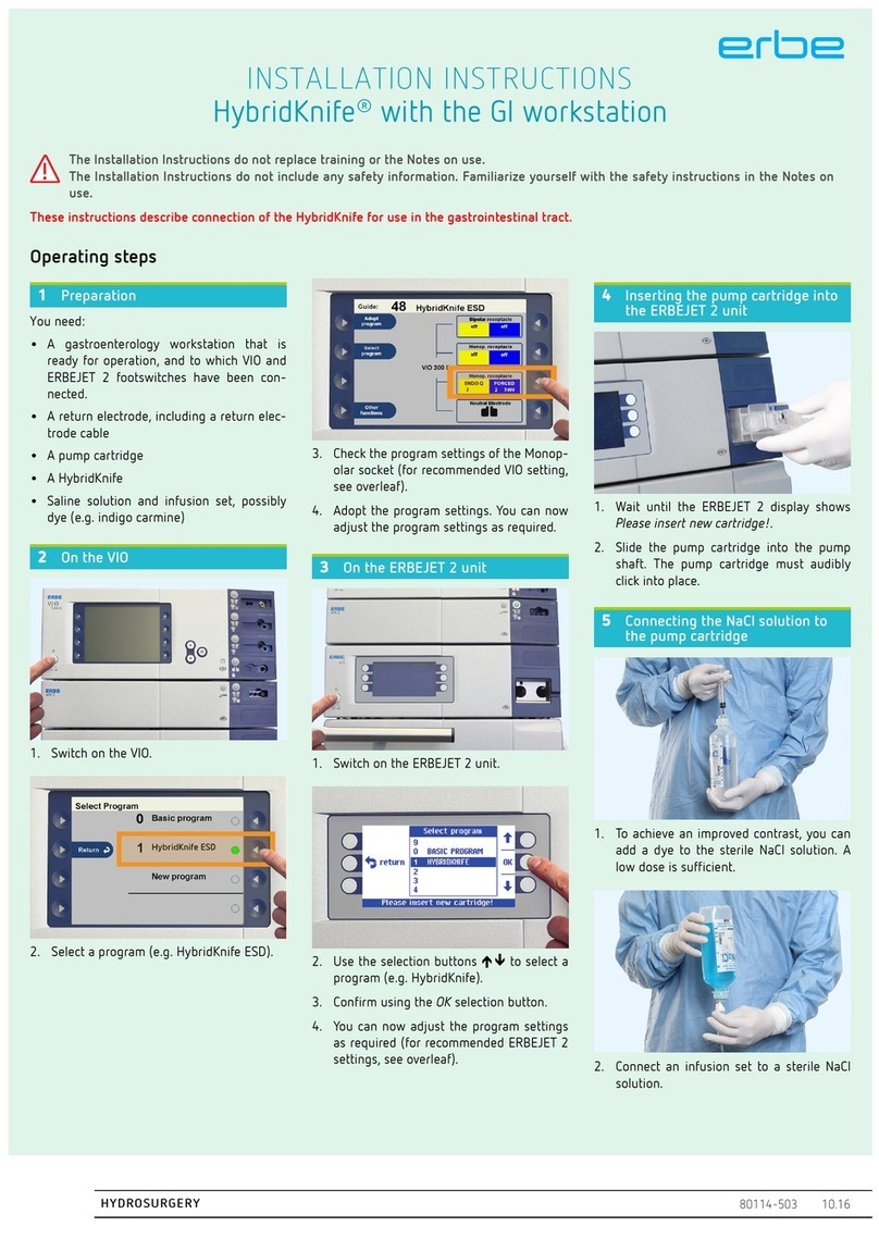 Erbe HybridKnife GI installation instructions