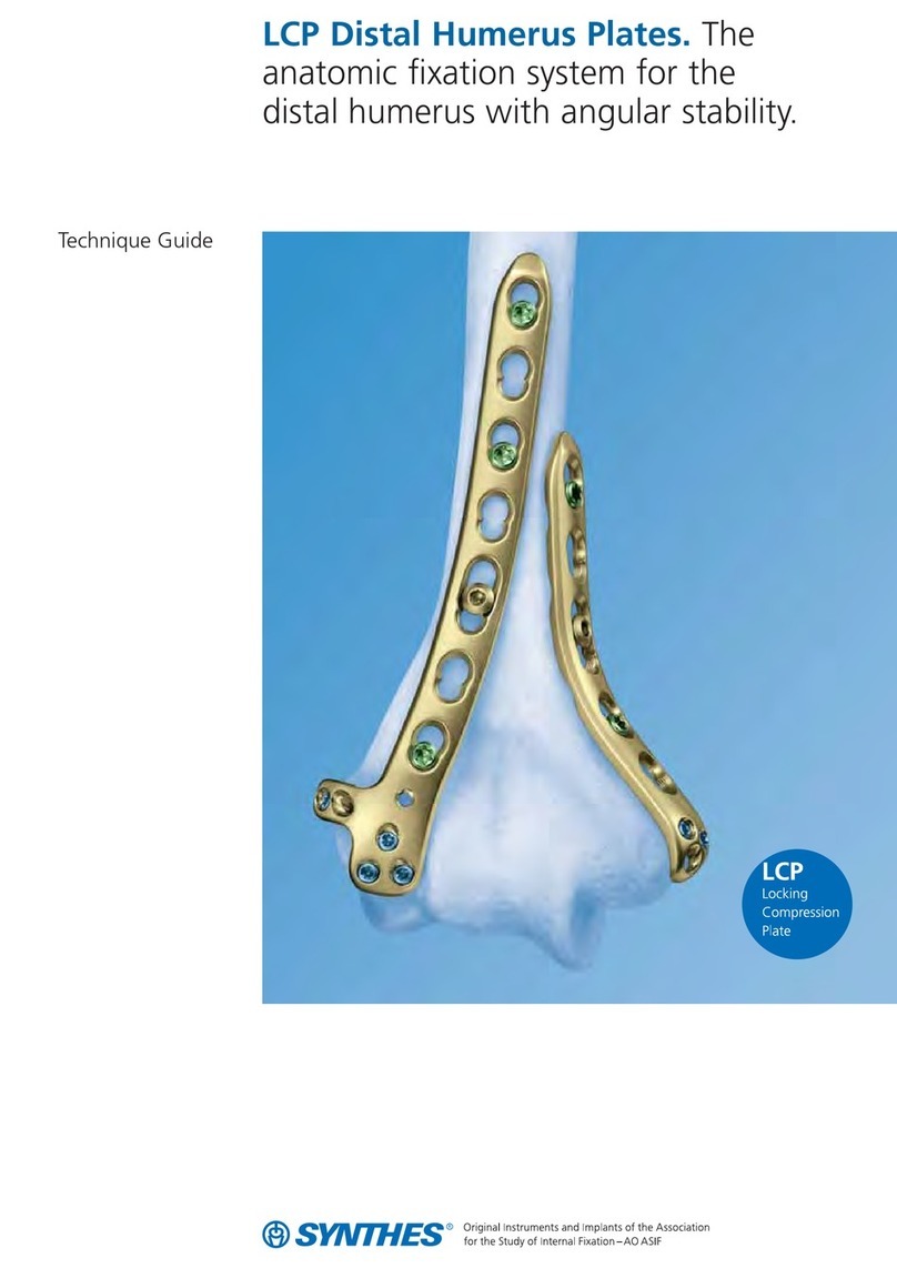 Synthes LCP Distal Humerus Plates User manual Synthes LCP Distal Humerus Plates User manual