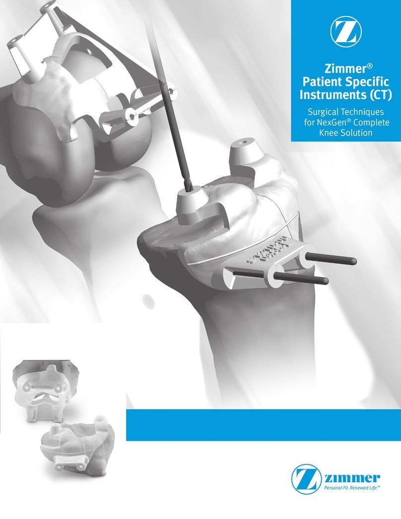 Zimmer NexGen Surgical Techniques