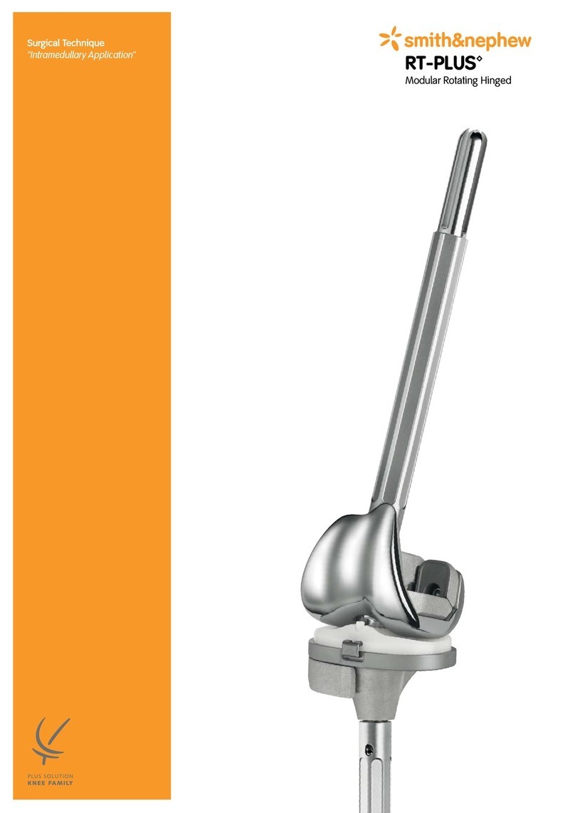 Smith & Nephew RT-PLUS User manual Smith & Nephew RT-PLUS User manual
