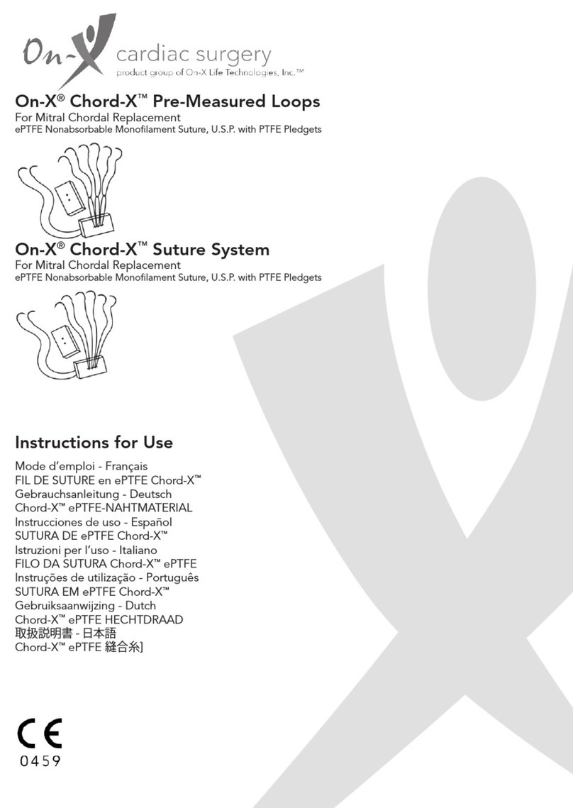 On-X Chord-X Series Instructions for use