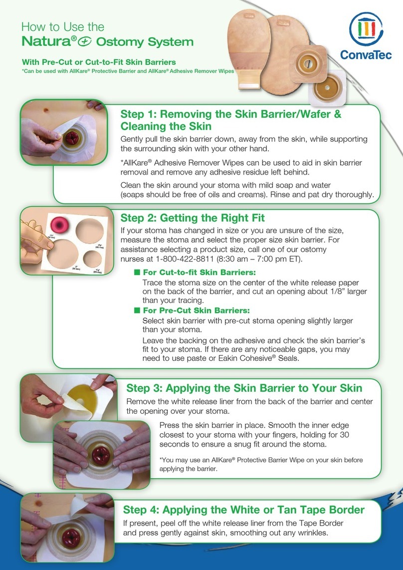 ConvaTec USA Natura Ostomy System How to use