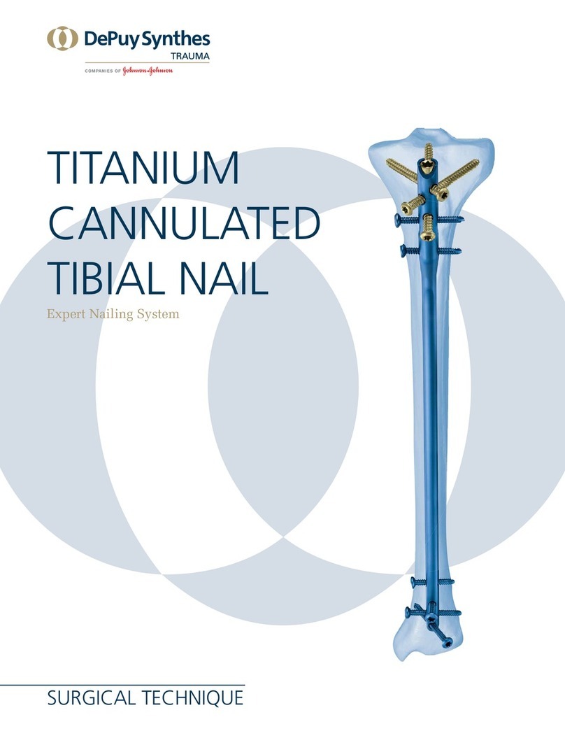 Johnson & Johnson DePuy Synthes TRAUMA Titanium Cannulated Tibial... User manual Johnson & Johnson DePuy Synthes TRAUMA Titanium Cannulated Tibial... User manual