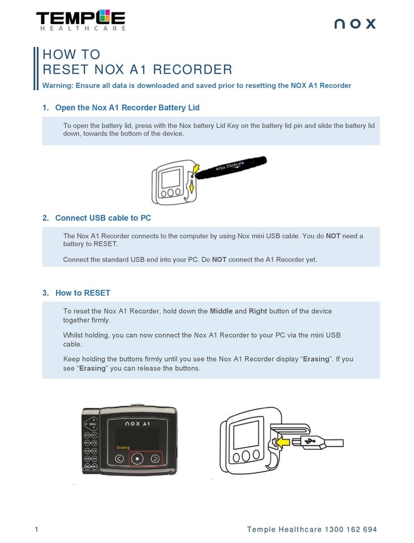nox A1 Resetting guide